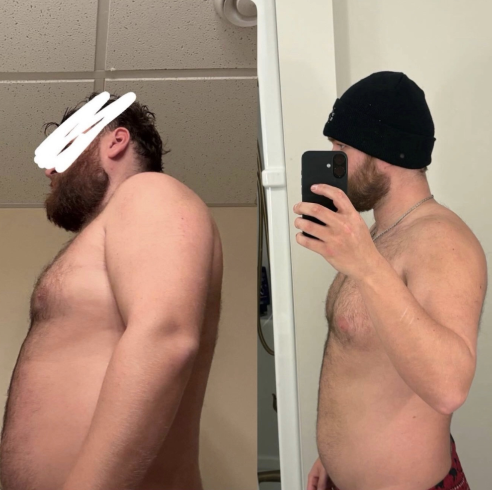 Before and after transformation of Seth, 35